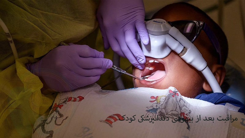 مراقبت بعد از بیهوشی دندانپزشکی کودک